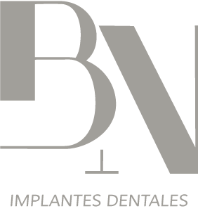implantes dentales 