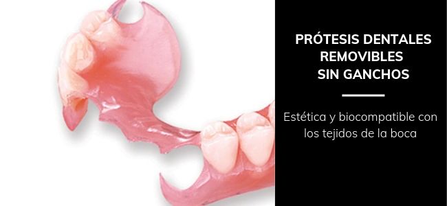 protesis dental sin ganchos metal