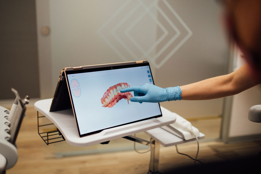 Implantes-dentales-escanner